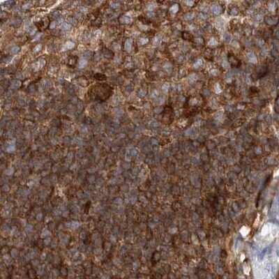 Immunohistochemistry-Paraffin: NFkB p100/p52 Antibody [NBP1-87759]