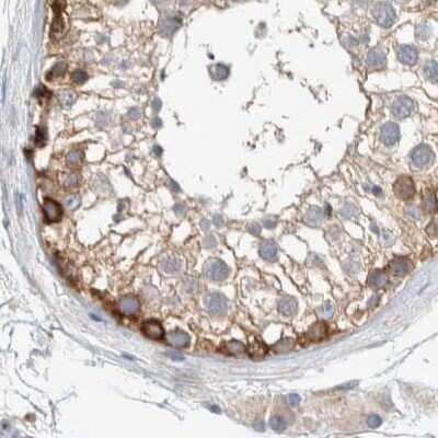 Immunohistochemistry-Paraffin: NFkB p100/p52 Antibody [NBP1-87759]