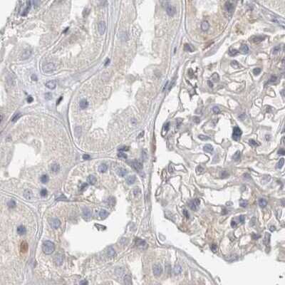 Immunohistochemistry-Paraffin: NFkB p100/p52 Antibody [NBP1-87759]