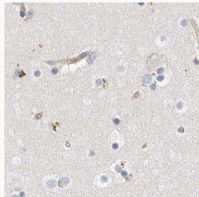 Immunohistochemistry-Paraffin: NFkB p100/p52 Antibody [NBP1-87759]