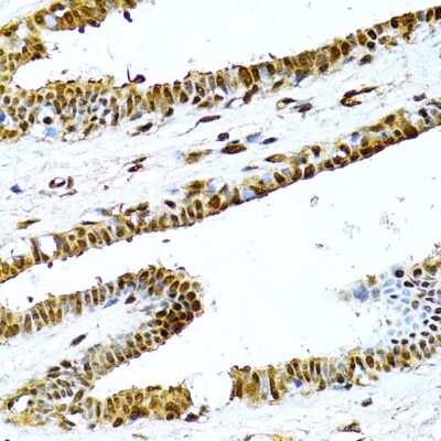 Immunohistochemistry-Paraffin: NFkB p100/p52 Antibody - BSA Free [NBP2-95200]