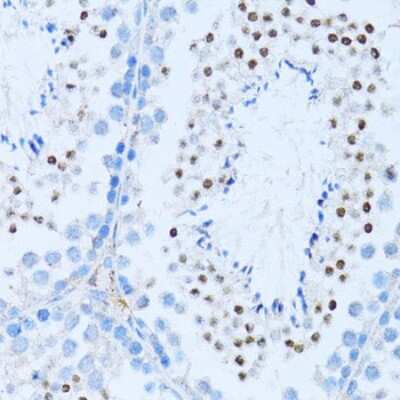Immunohistochemistry-Paraffin: NFkB p100/p52 Antibody - BSA Free [NBP2-95200]