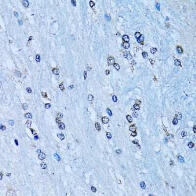 Immunohistochemistry-Paraffin: NFkB p100/p52 Antibody - BSA Free [NBP2-95200]