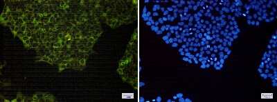 Immunocytochemistry/ Immunofluorescence: NFkB p100/p52 Antibody (S04-4D6) [NBP3-14959]