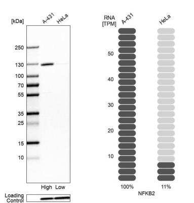 Western Blot: NFkB p100/p52 Antibody [NBP1-87759]