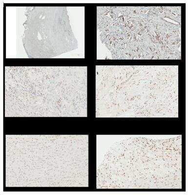 Immunohistochemistry-Paraffin: NFkB p105/p50 Antibody (2J10D7) - BSA Free [NB100-56583]