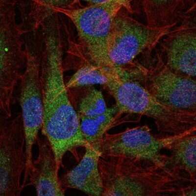 Immunocytochemistry/ Immunofluorescence: NFkB p105/p50 Antibody (5D10D11) - BSA Free [NBP2-22178]