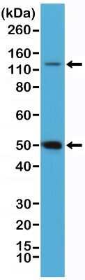 Western Blot: NFkB p105/p50 Antibody (RM299) [NBP2-61568]