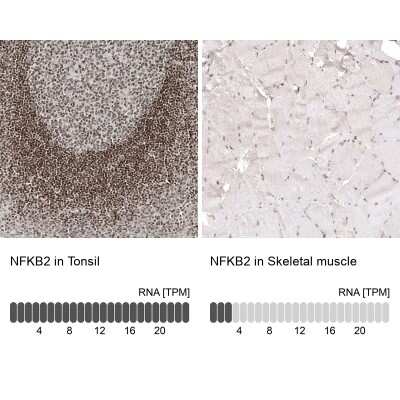 Immunohistochemistry-Paraffin: NFkB2/NFkB p100 Antibody (CL8266) [NBP2-88914]