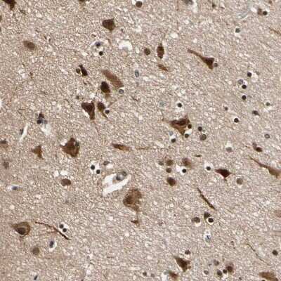 Immunohistochemistry-Paraffin: NGEF Antibody [NBP1-88820]