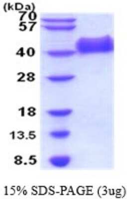 SDS-PAGE: Recombinant Human NGFR/TNFRSF16/p75NTR His Protein [NBP2-52198]