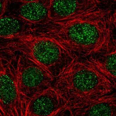 Immunocytochemistry/ Immunofluorescence: NGFI-B alpha/Nur77/NR4A1 Antibody [NBP2-58600]