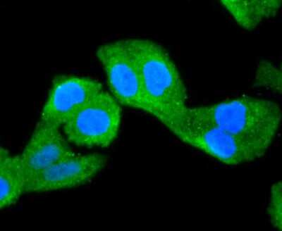 Immunocytochemistry/ Immunofluorescence: NGFI-B alpha/Nur77/NR4A1 Antibody (JM59-11) [NBP2-66980]