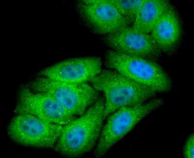 Immunocytochemistry/ Immunofluorescence: NGFI-B alpha/Nur77/NR4A1 Antibody (JM59-11) [NBP2-66980]