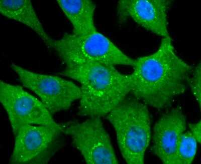 Immunocytochemistry/ Immunofluorescence: NGFI-B alpha/Nur77/NR4A1 Antibody (JM59-11) [NBP2-66980]