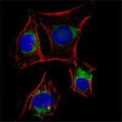 Immunocytochemistry/ Immunofluorescence: NGFR/TNFRSF16/p75NTR Antibody (2F1C2) - Azide and BSA Free [NBP2-80874]