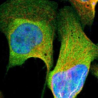 Immunocytochemistry/ Immunofluorescence: NGFR/TNFRSF16/p75NTR Antibody [NBP1-85769]