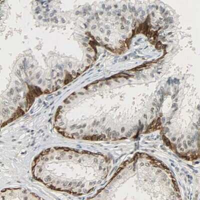 Immunohistochemistry-Paraffin: NGFR/TNFRSF16/p75NTR Antibody [NBP1-85769]