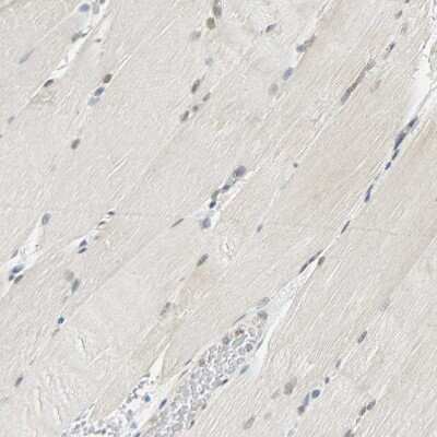 Immunohistochemistry-Paraffin: NGFR/TNFRSF16/p75NTR Antibody [NBP1-85769]