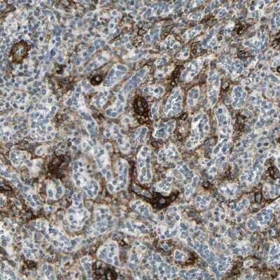 Immunohistochemistry-Paraffin: NGFR/TNFRSF16/p75NTR Antibody [NBP1-85769]