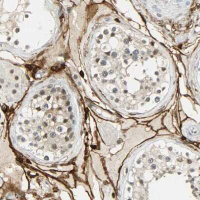 Immunohistochemistry-Paraffin: NGFR/TNFRSF16/p75NTR Antibody [NBP1-85769]