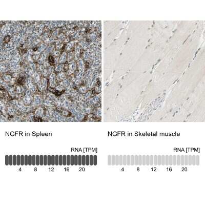 Immunohistochemistry-Paraffin: NGFR/TNFRSF16/p75NTR Antibody [NBP1-85769]