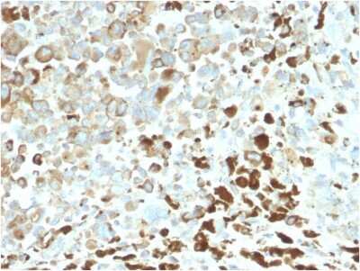 Immunohistochemistry-Paraffin: NGFR/TNFRSF16/p75NTR Antibody (NGFR/2550R) - Azide and BSA Free [NBP3-08566]