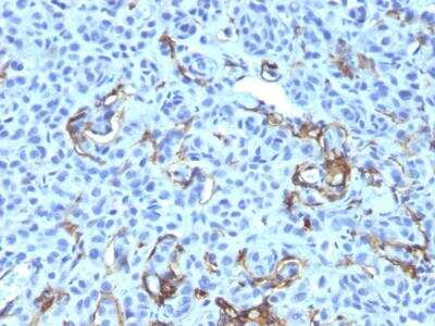 Immunohistochemistry-Paraffin: NGFR/TNFRSF16/p75NTR Antibody (NGFR5 + NTR/912) - Azide and BSA Free [NBP2-47967]