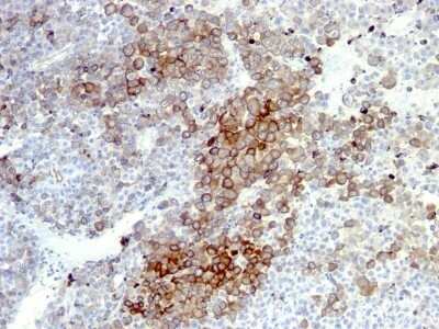 Immunohistochemistry-Paraffin: NGFR/TNFRSF16/p75NTR Antibody (NGFR5 + NTR/912) [NBP2-44877]
