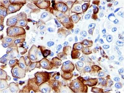 Immunohistochemistry-Paraffin: NGFR/TNFRSF16/p75NTR Antibody (NGFR5) [NBP2-44874]