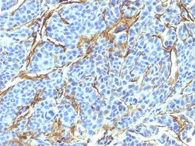 Immunohistochemistry-Paraffin: NGFR/TNFRSF16/p75NTR Antibody (NTR/912) - IHC-Prediluted [NBP2-48297]