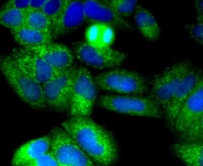 Immunocytochemistry/ Immunofluorescence: NGFR/TNFRSF16/p75NTR Antibody (SA39-02) [NBP2-67296]