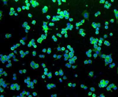 Immunocytochemistry/ Immunofluorescence: NGFR/TNFRSF16/p75NTR Antibody (SA39-02) [NBP2-67296]