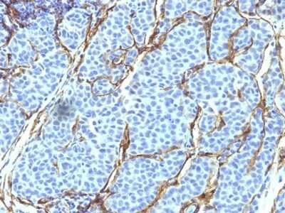 Immunohistochemistry-Paraffin: NGFR/TNFRSF16/p75NTR Antibody (SPM299) [NBP2-44875]