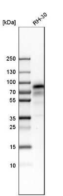 Western Blot: NGFR/TNFRSF16/p75NTR Antibody [NBP1-85769]