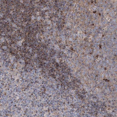 Immunohistochemistry-Paraffin: NGLY1 Antibody [NBP1-83792]