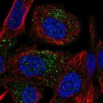 Immunocytochemistry/ Immunofluorescence: NGX6 Antibody [NBP2-57356]