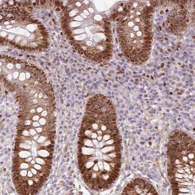 Immunohistochemistry-Paraffin: NGX6 Antibody [NBP2-30610]