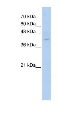 Western Blot: NGX6 Antibody [NBP1-60075]