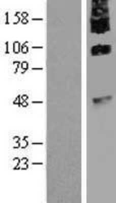 Western Blot: NGX6 Overexpression Lysate [NBP2-07036]
