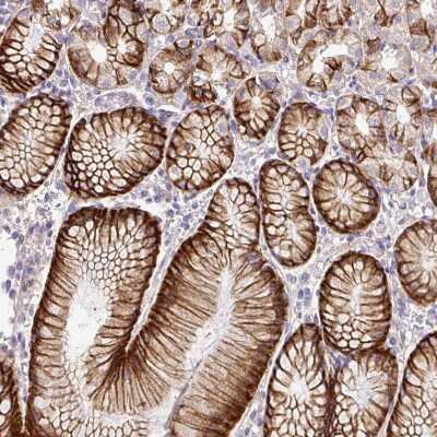 Immunohistochemistry-Paraffin: NHE1/SLC9A1 Antibody [NBP2-38683]