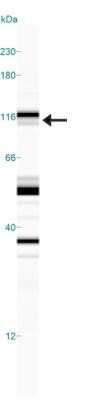 Simple Western: NHE3/SLC9A3 [p Ser552] Antibody (14D5)Azide and BSA Free [NBP2-80877]