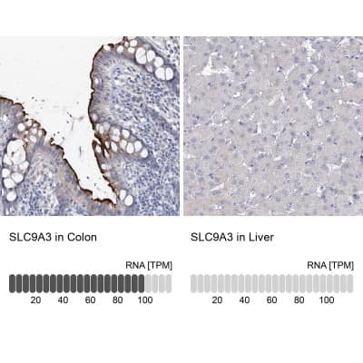 Immunohistochemistry-Paraffin: NHE3/SLC9A3 Antibody [NBP1-82574]