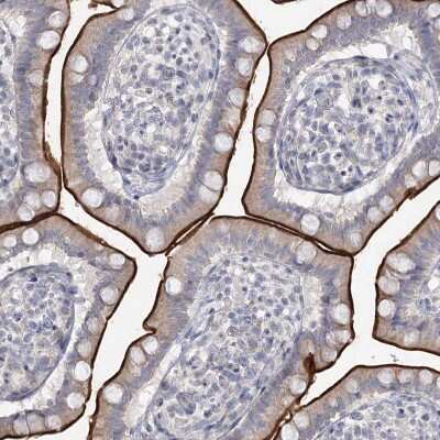 Immunohistochemistry-Paraffin: NHE3/SLC9A3 Antibody [NBP1-82574]