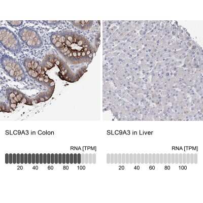 Immunohistochemistry-Paraffin: NHE3/SLC9A3 Antibody [NBP1-82575]