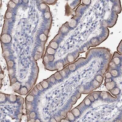 Immunohistochemistry-Paraffin: NHE3/SLC9A3 Antibody [NBP1-82575]
