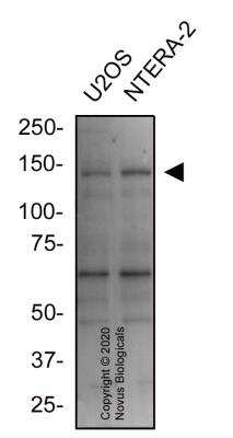 Western Blot: NHE3/SLC9A3 AntibodyBSA Free [NBP3-00589]