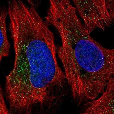 Immunocytochemistry/ Immunofluorescence: NHE6/SLC9A6 Antibody [NBP2-38877]