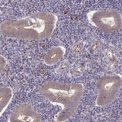 Immunohistochemistry-Paraffin: NHE6/SLC9A6 Antibody [NBP2-32463]