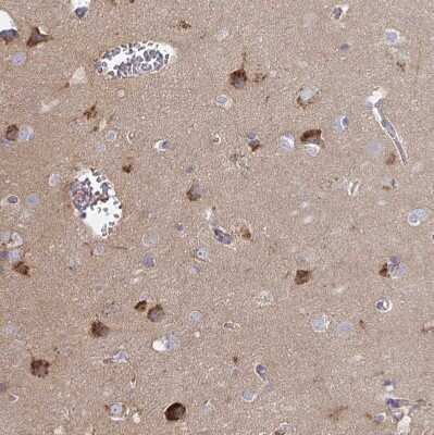 Immunohistochemistry-Paraffin: NHE6/SLC9A6 Antibody [NBP2-38877]